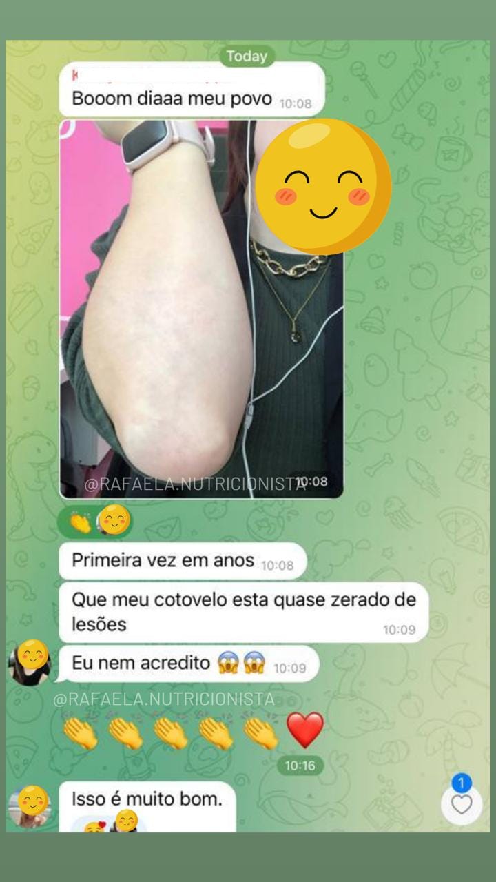 Depoimento real de aluno com antes e depois da psoríase 8